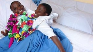 Tanzanian conjoined twins die aged 21