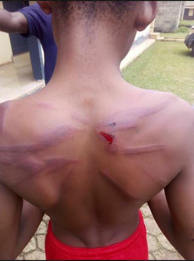 14-yr old given 36 lashes by police for ‘insubordination’