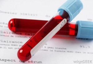 Alleged contaminated KATH blood tests negative for HIV, Syphilis