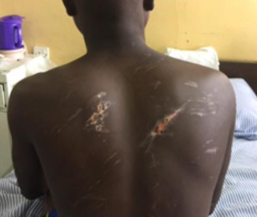 CHRAJ recommends GHS 30,000 compensation for 16-year-old brutalized by soldiers