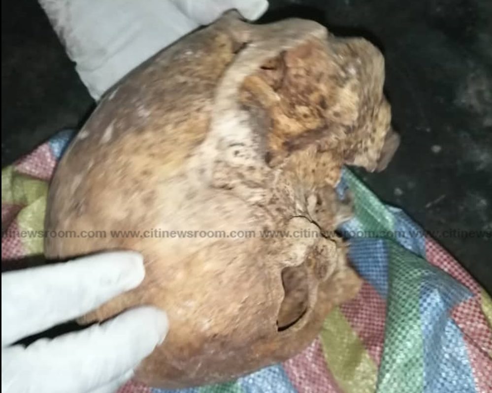 Offinso: Police arrest two persons in possession of human skull