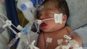 Baby cut from womb in US murder case dies
