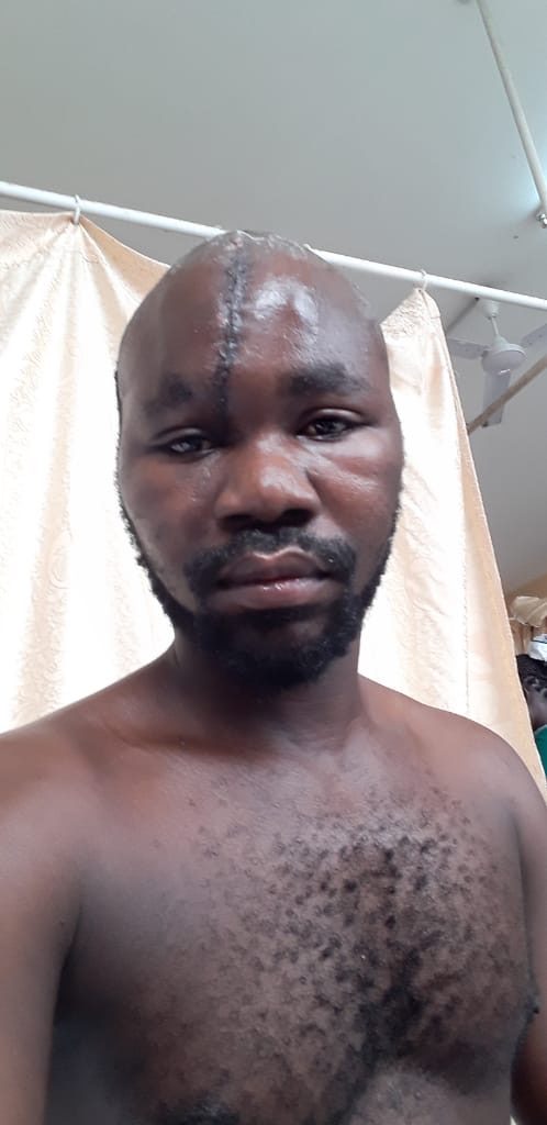 33-year old Isaac Vinepon appeals for GHc26,000 to cater for head surgery