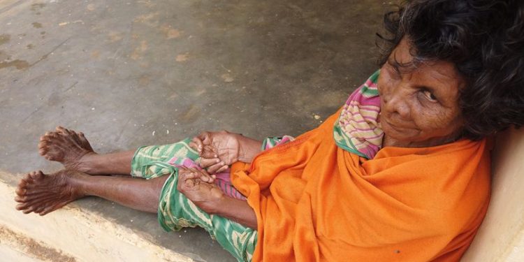 Woman with record breaking 31 fingers and toes branded 'witch'