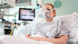 CPAP devices are less invasive than a ventilator