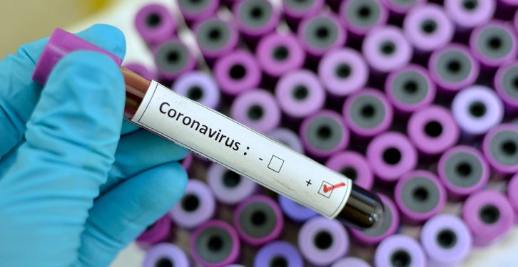 Blood sample with respiratory coronavirus positive