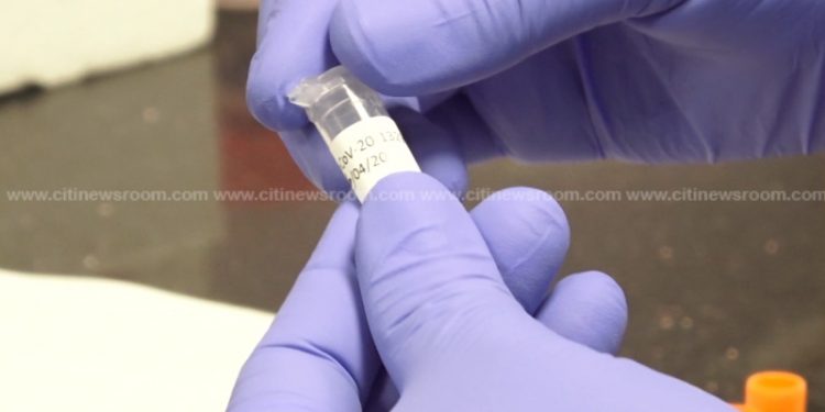 sample for coronavirus testing
