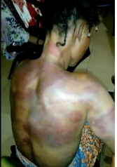 An alleged who was brutalized at the healing centre in the Upper East Region