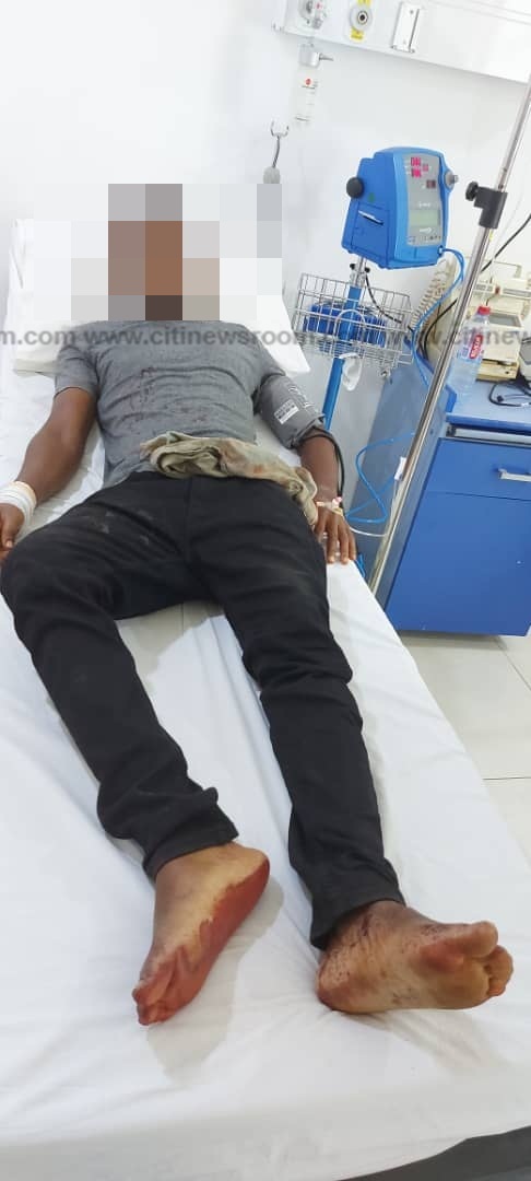 East Legon: Motorcyclist shot by soldier in military pick-up vehicle