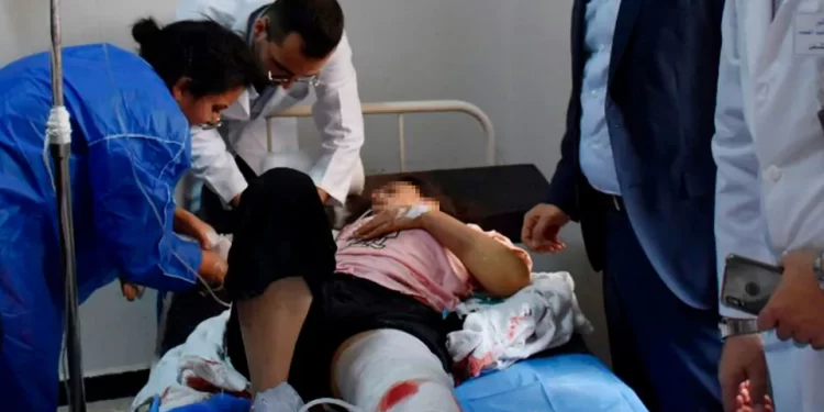 Doctors treat a Syrian woman injured from a drone attack that hit a packed military graduation ceremony in the central city of Homs, Syria, Oct 5, 2023. A portion of this image has been blurred by CNN to protect an individual's identity.