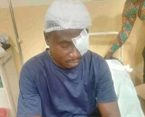 Student stabs teacher in the eye – GNAT demands justice for victim